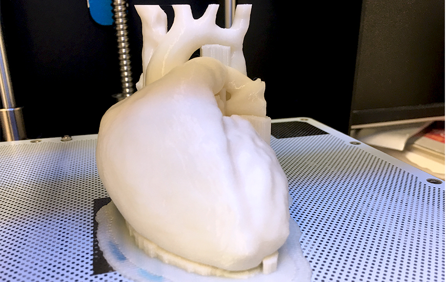 ZORTRAX Case Study GUM 3D printed heart