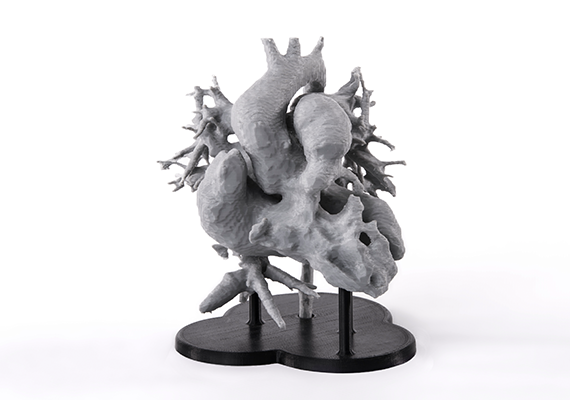 Skomplikowany model ludzkiego serca stworzony w oparciu o skan MRI. Model został wydrukowany w 3D przy użyciu filamentu Z-PLA oraz rozpuszczalnego materiału podporowego, co pozwoliło dokładnie odwzorować złożoność organu.